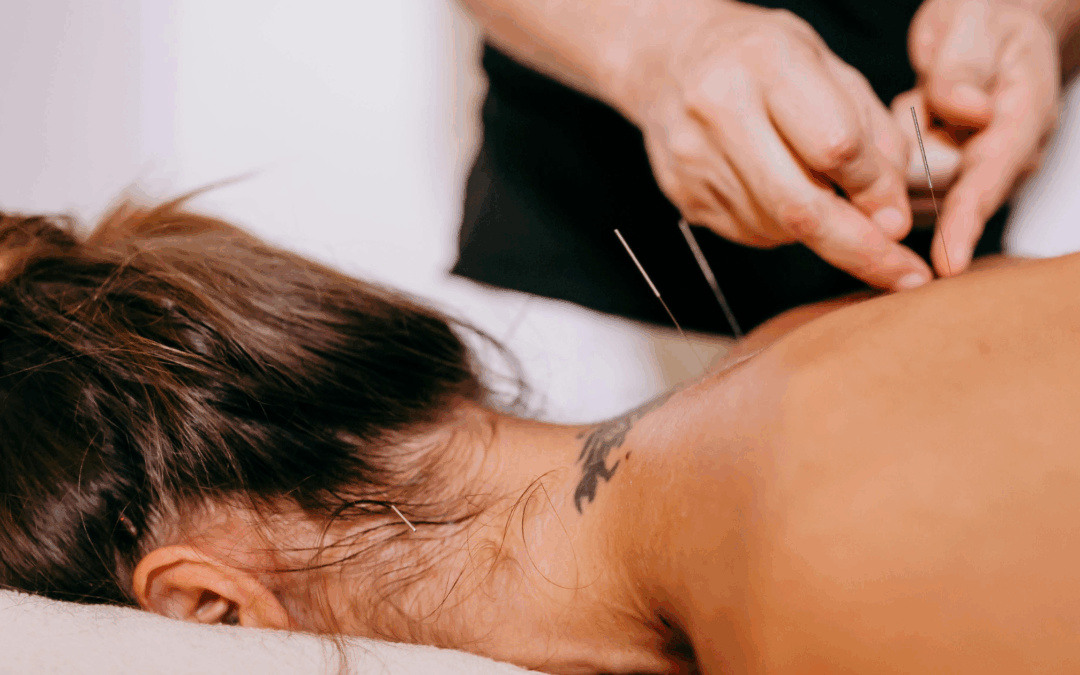 Acupuncture with Lacey Park in Bedford NS
