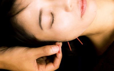 The Science of Cosmetic Acupuncture: How Ancient Medicine Meets Modern Skin Physiology