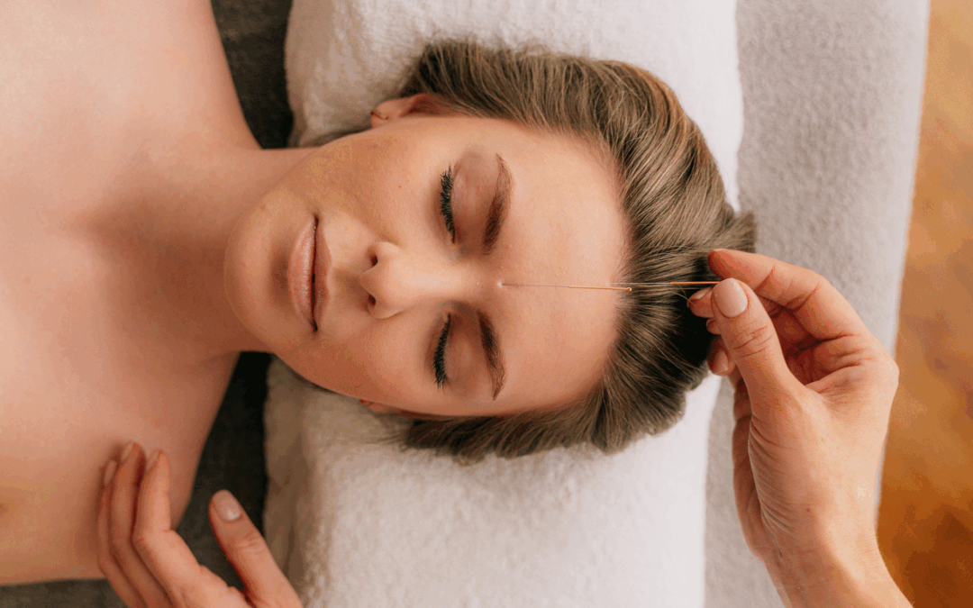 Does Acupuncture Work? What New Brunswick Women Are Discovering About Traditional Chinese Medicine
