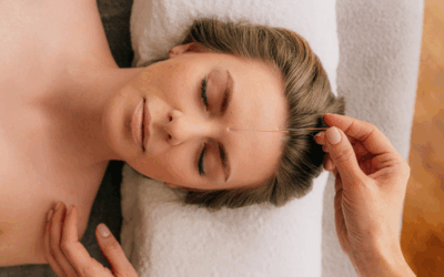 Does Acupuncture Work? What New Brunswick Women Are Discovering About Traditional Chinese Medicine