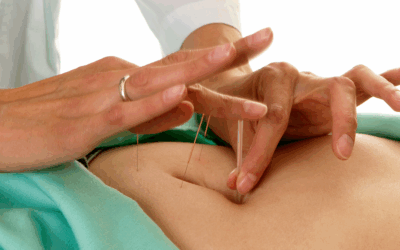 Is Florenceville Ready for Community Acupuncture?