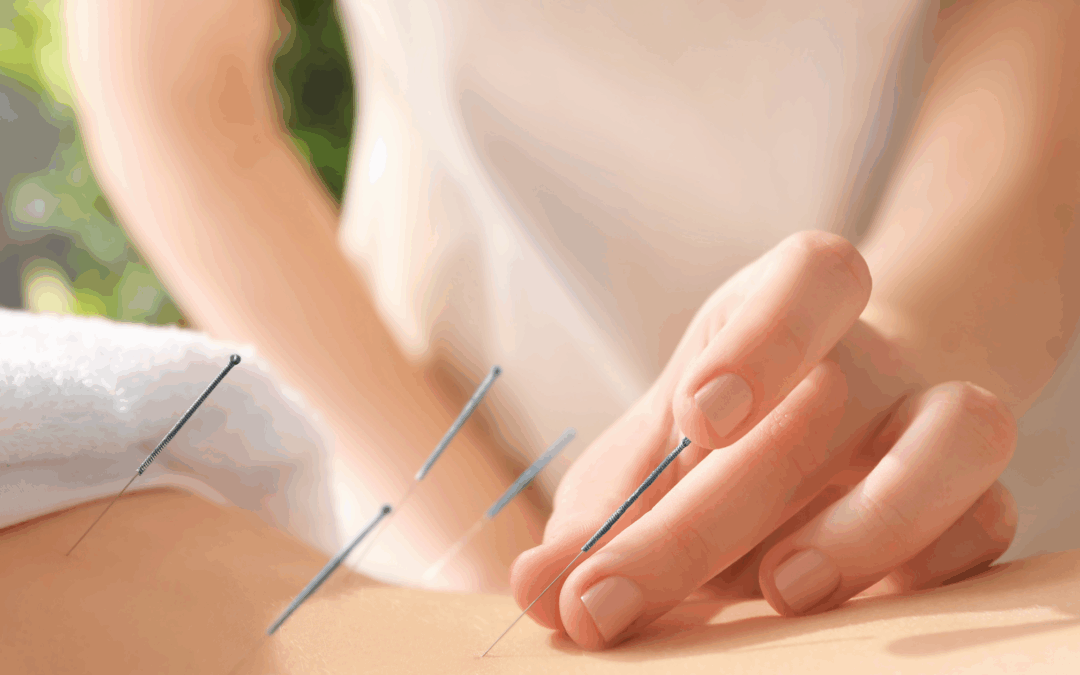 Acupuncture in Bedford, NS: How to Book at the CCATCM Student Clinic