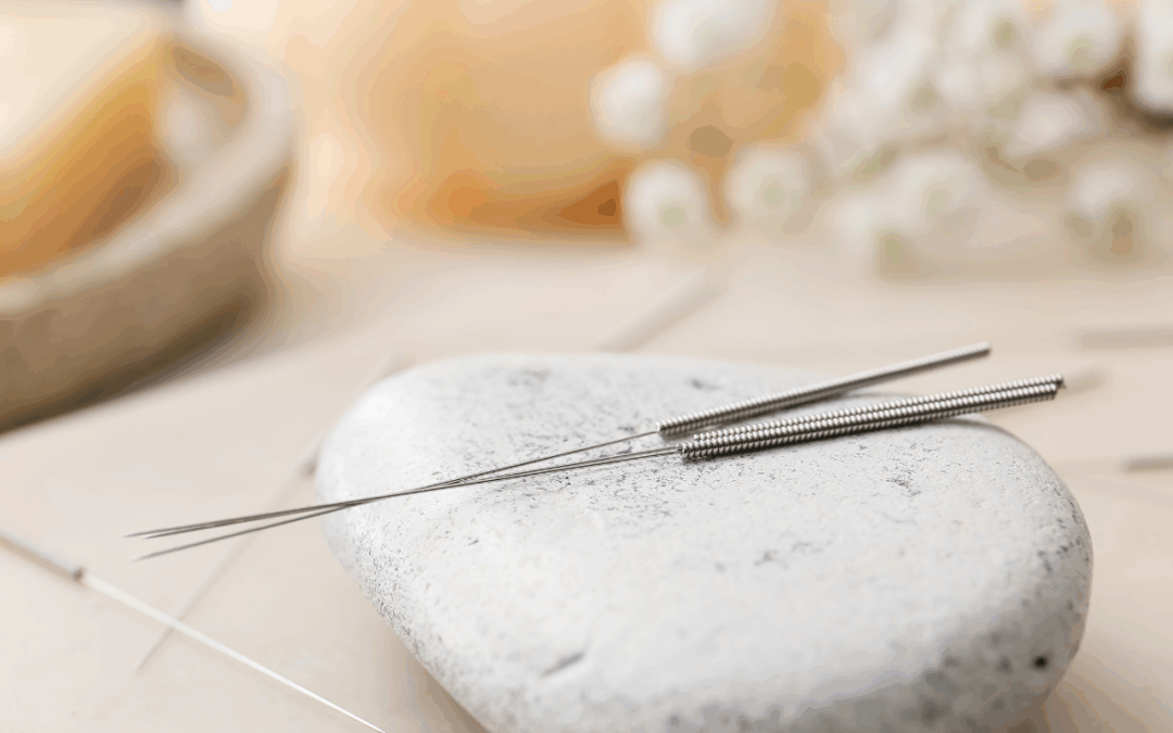 What to Expect from Your First Acupuncture Visit in New Brunswick