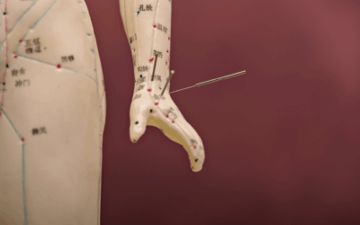 Understanding Traditional Chinese Medicine: A Different Way of Seeing Health