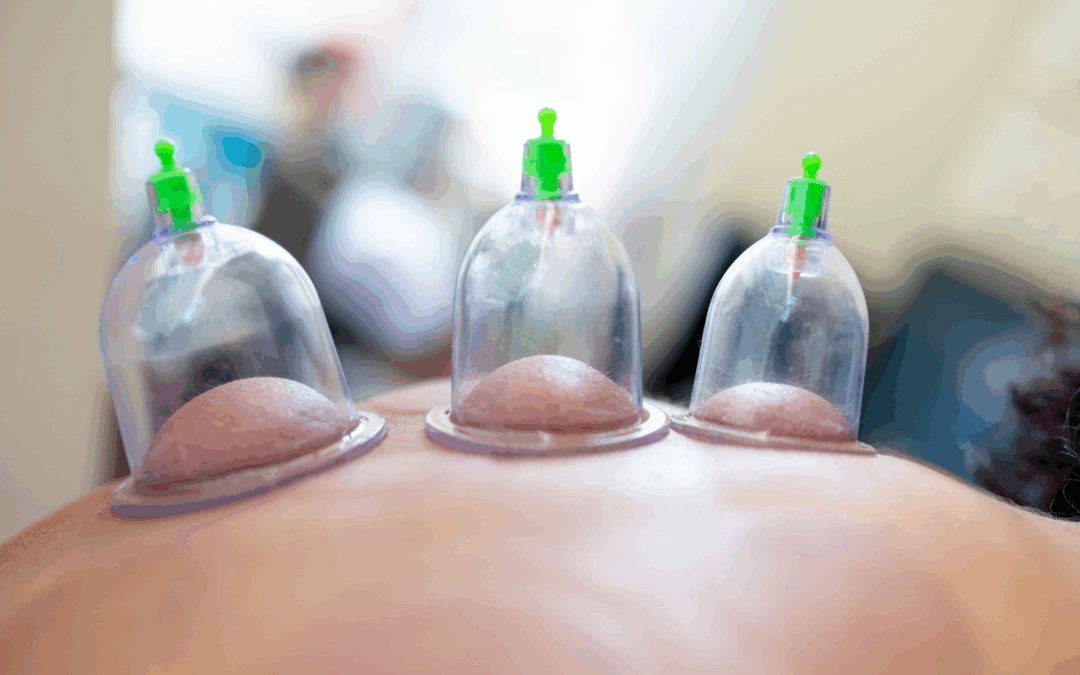 Acupuncture in New Brunswick: A Complete Guide for Women’s Health and Wellness