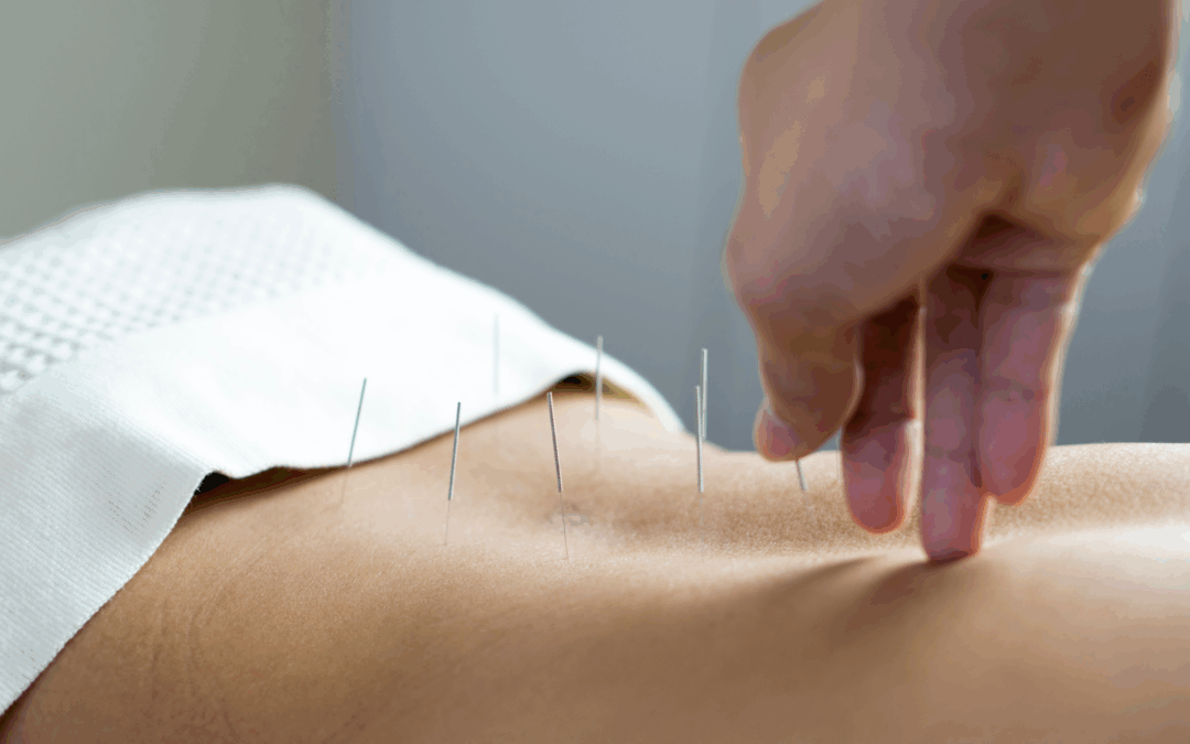 A Realistic Guide to Preparing for Acupuncture When You Are a Busy Woman