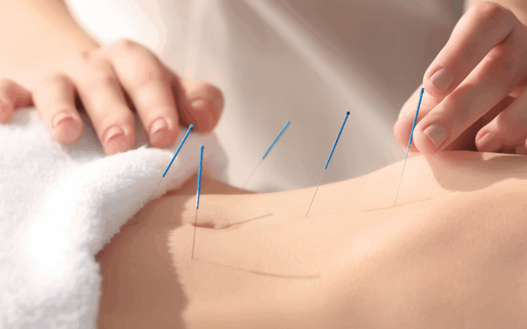 Acupuncture for the Woman Who Has Tried Everything but Still Feels Off