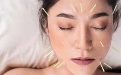 Is This Normal? A Woman’s Guide to Everything That Happens During Acupuncture