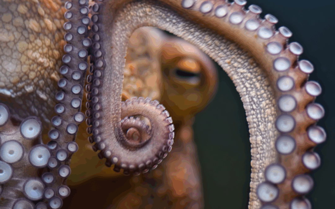 Bedford Cupping Therapy: No, You Were Not Attacked by an Octopus