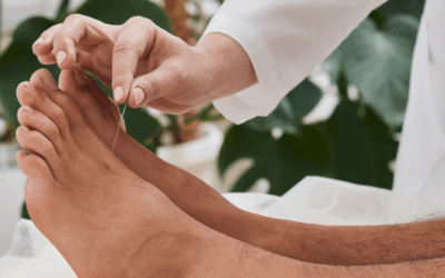 Is Student Acupuncture Safe? Honest Answers.