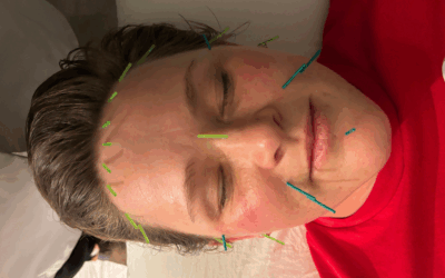 You Can’t Moisturize Your Way Out of a Nervous System Meltdown