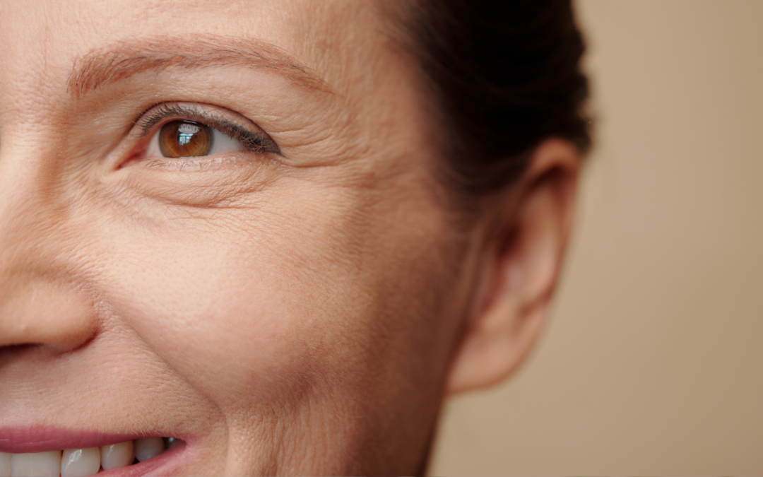 All I See Are Wrinkles (and I Mean That With Love)