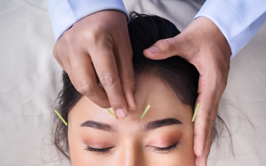 The Cosmetic Acupuncture Glow Is Not Skin Deep