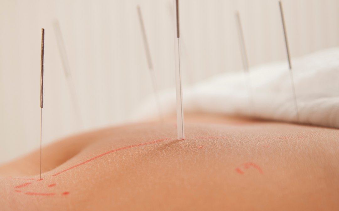Things I’ve Learned in Acupuncture School That Were Definitely Not on the Syllabus