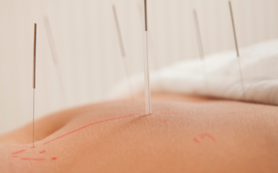 Things I’ve Learned in Acupuncture School That Were Definitely Not on the Syllabus