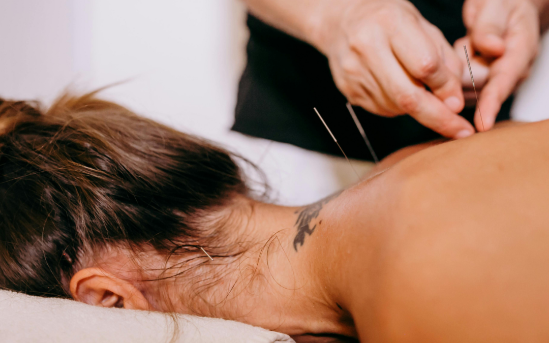 What Student Acupuncture Clinic Is Actually Like